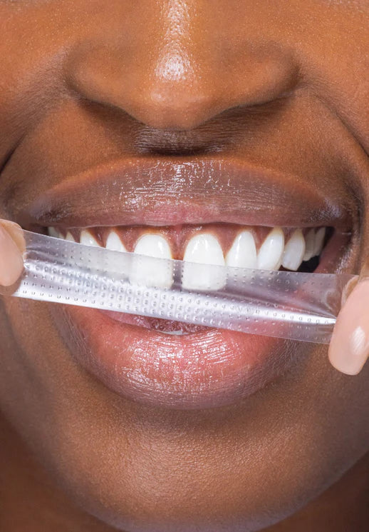 🔥Nu 40% korting🎁PAP+ Whitening Strips – Stralend witte tanden met simpele strips