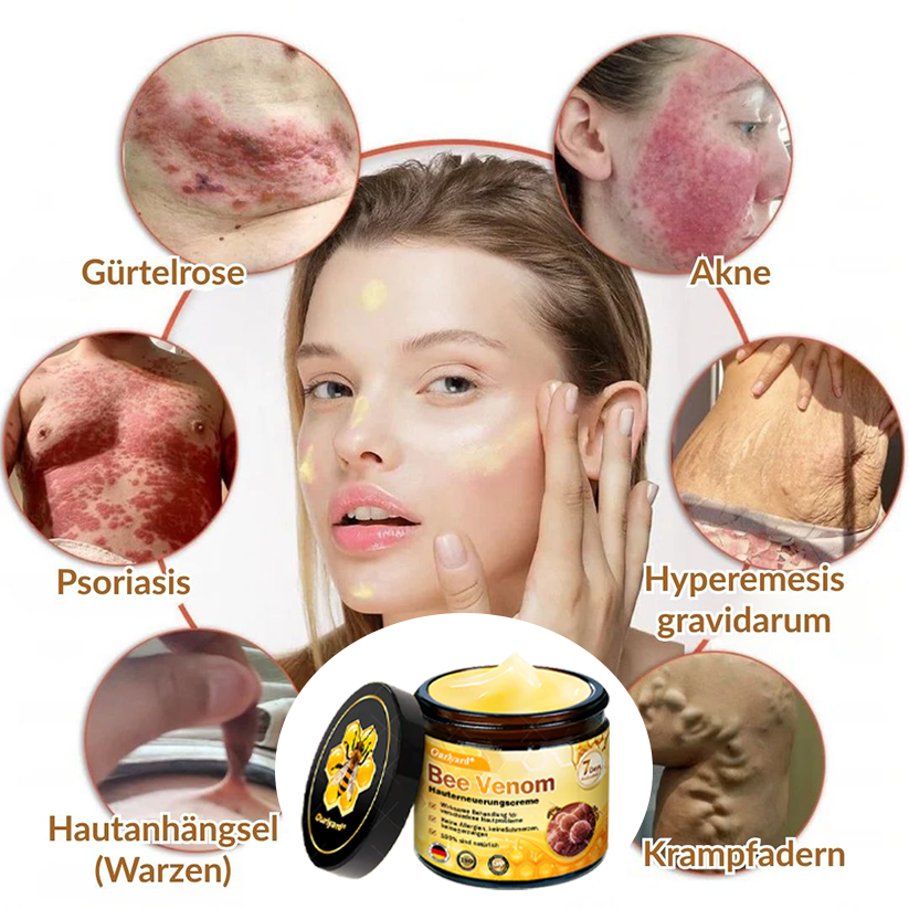 ✨✨Krem regenerujący skórę Ourlyard® z jadem pszczelim - 🔥Ograniczona czasowo zniżka 80%🔥