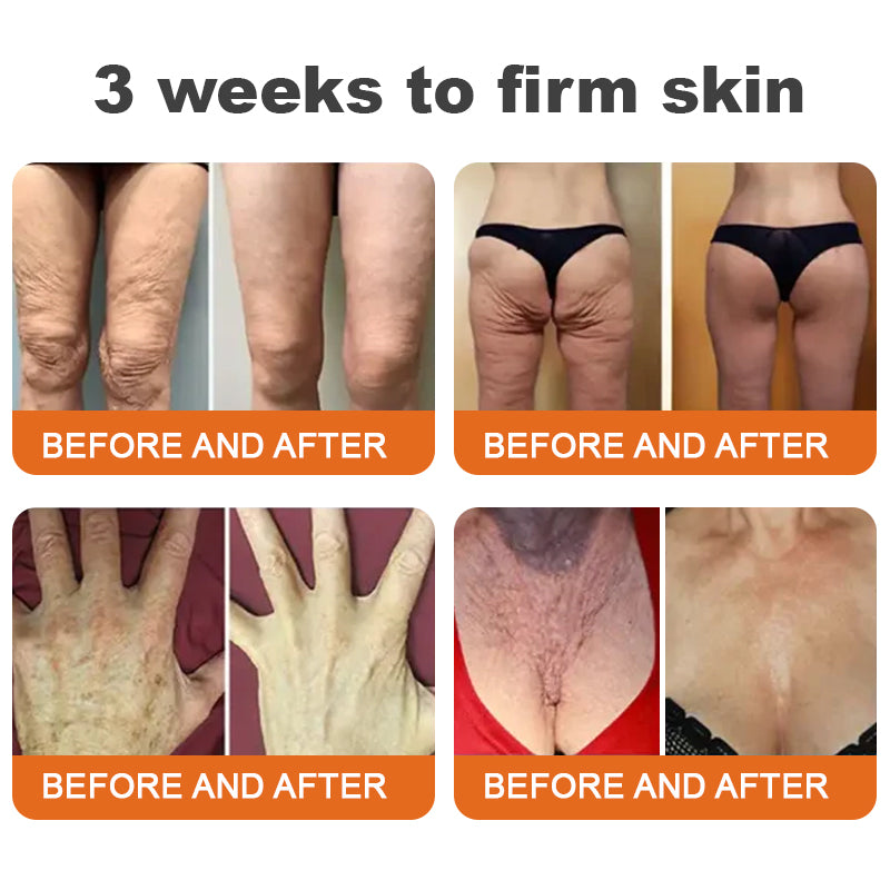 🐝💖Sérum raffermissant Flysmus™ Botox au venin d'abeille (fabriqué et expédié en Allemagne) – DERNIER JOUR -70 %
