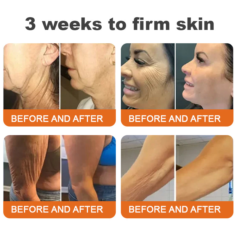 🐝💖Sérum raffermissant Flysmus™ Botox au venin d'abeille (fabriqué et expédié en Allemagne) – DERNIER JOUR -70 %