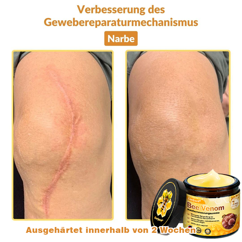 ✨✨Krem regenerujący skórę Ourlyard® z jadem pszczelim - 🔥Ograniczona czasowo zniżka 80%🔥