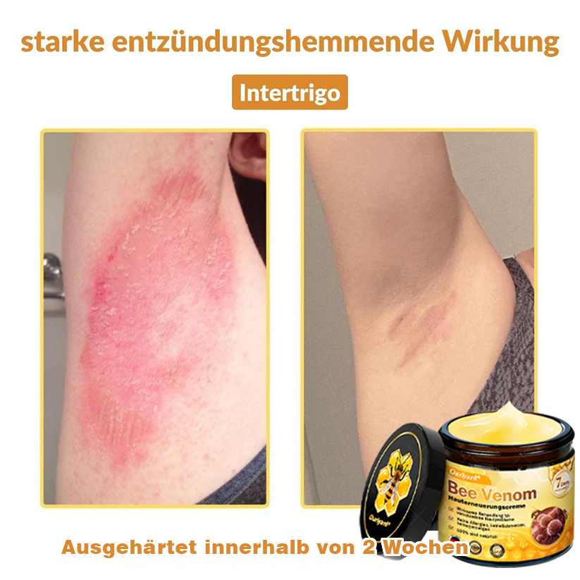 ✨✨Krem regenerujący skórę Ourlyard® z jadem pszczelim - 🔥Ograniczona czasowo zniżka 80%🔥