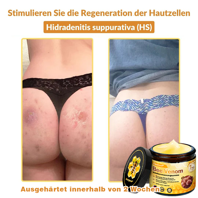 ✨✨Krem regenerujący skórę Ourlyard® z jadem pszczelim - 🔥Ograniczona czasowo zniżka 80%🔥