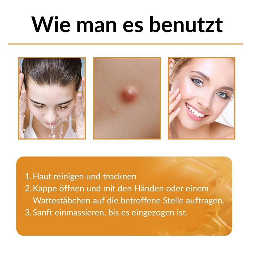 ✨✨Krem regenerujący skórę Ourlyard® z jadem pszczelim - 🔥Ograniczona czasowo zniżka 80%🔥