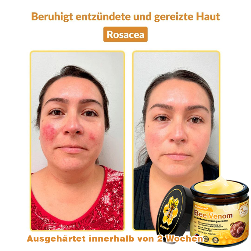 ✨✨Krem regenerujący skórę Ourlyard® z jadem pszczelim - 🔥Ograniczona czasowo zniżka 80%🔥