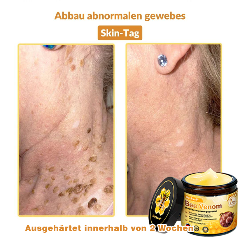 ✨✨Krem regenerujący skórę Ourlyard® z jadem pszczelim - 🔥Ograniczona czasowo zniżka 80%🔥