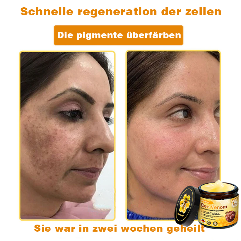 ✨✨Krem regenerujący skórę Ourlyard® z jadem pszczelim - 🔥Ograniczona czasowo zniżka 80%🔥