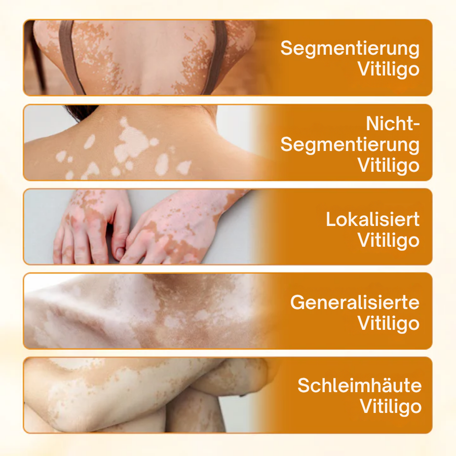 Crème au venin d'abeille Fivfivgo® VitiCalm,✔️95 % d'amélioration visible en 4 semaines, favorise la pigmentation et restaure le teint naturel de la peau