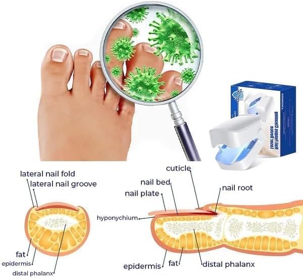 Dispositifs révolutionnaires et très efficaces de thérapie léger pour les maladies des ongles, la luminothérapie pour les champignons à ongles, le nettoyage et les soins des ongles (1 pièce)