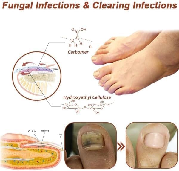 Dispositifs révolutionnaires et très efficaces de thérapie léger pour les maladies des ongles, la luminothérapie pour les champignons à ongles, le nettoyage et les soins des ongles (1 pièce)