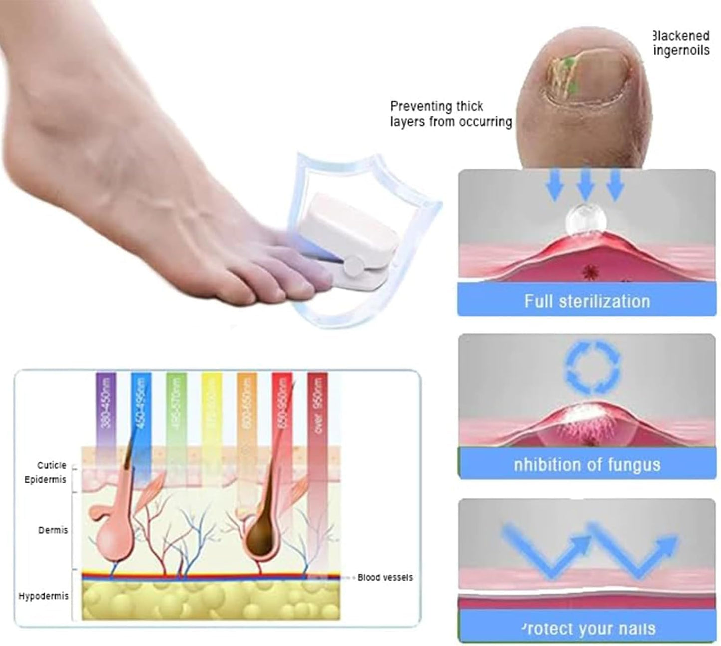 Dispositifs révolutionnaires et très efficaces de thérapie léger pour les maladies des ongles, la luminothérapie pour les champignons à ongles, le nettoyage et les soins des ongles (1 pièce)