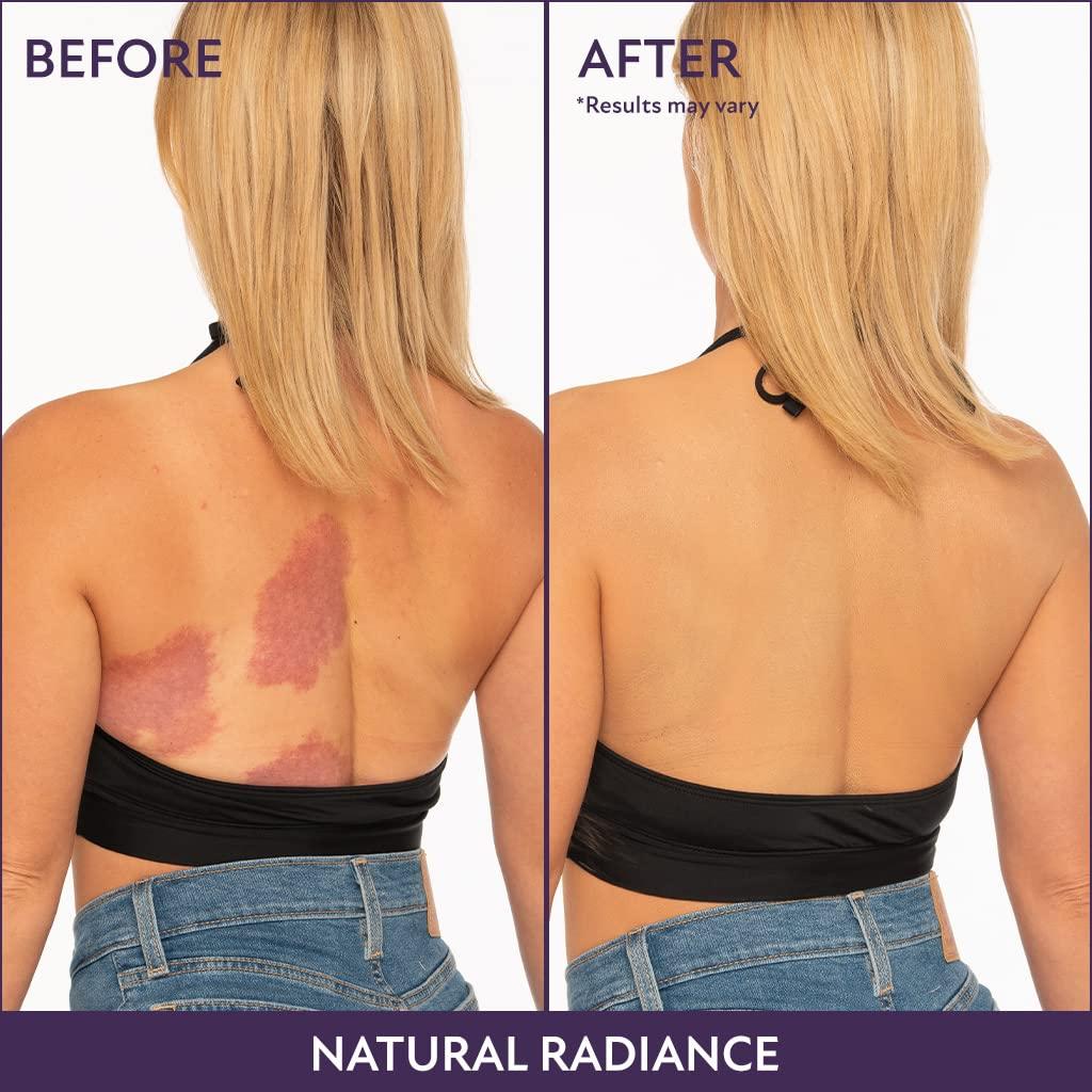 Sólo hoy🌟– ¡60% de descuento! Set de cobertura corporal completa (incluye Body Perfeccionador + Cepillo pulidor XL)