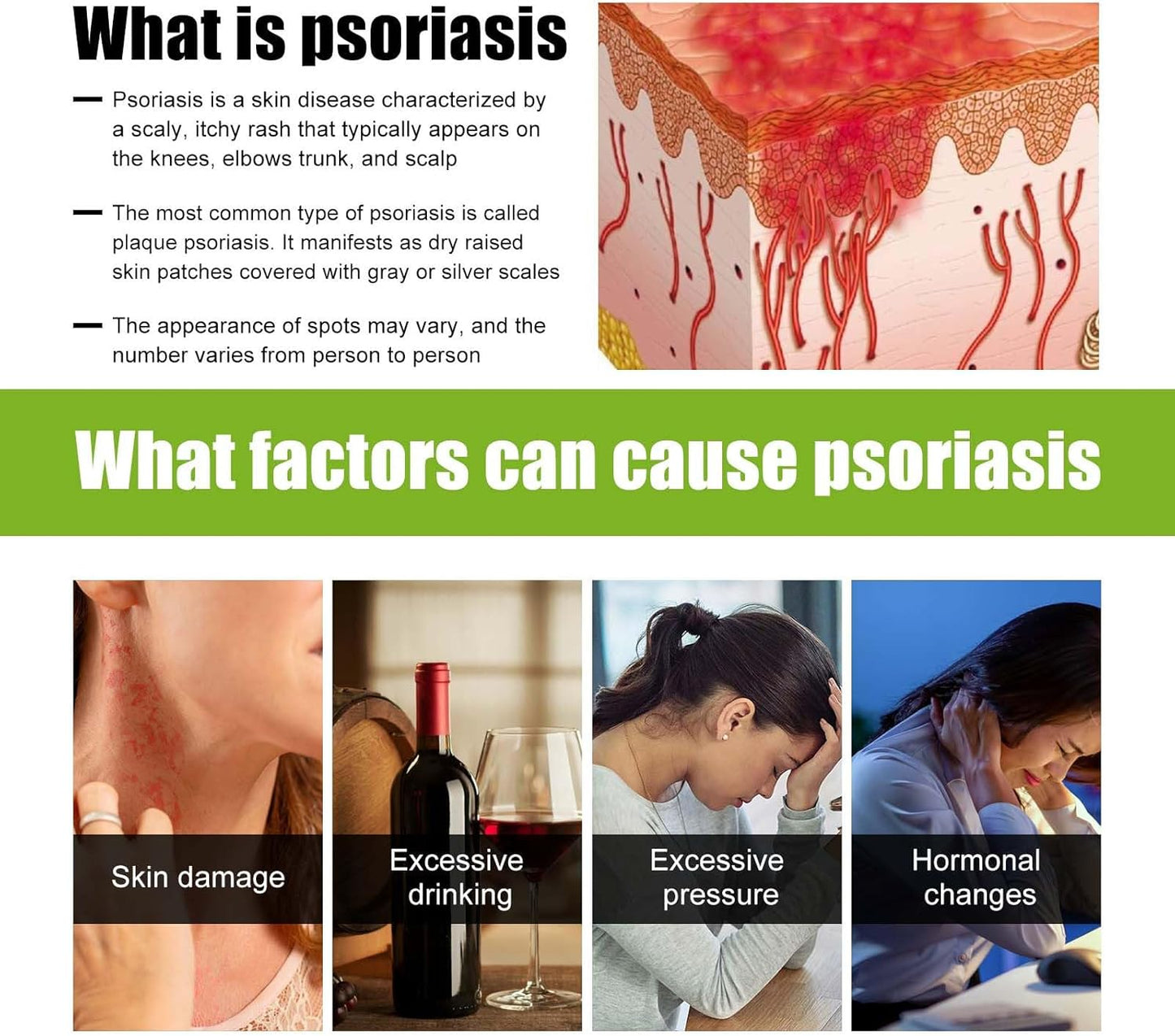 Todahof bienengift-psoriasis behandelingscrème, todahof bienengift-psoriasis behandeling crème, todahof bienengift-cream, psoriasis crème, beeergift psoriasis behandeling crème (3 stuks)