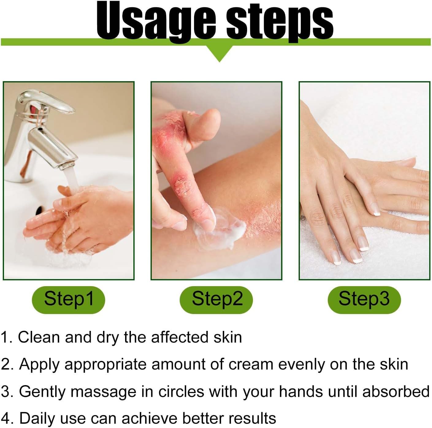 Todahof bienengift-psoriasis behandelingscrème, todahof bienengift-psoriasis behandeling crème, todahof bienengift-cream, psoriasis crème, beeergift psoriasis behandeling crème (3 stuks)