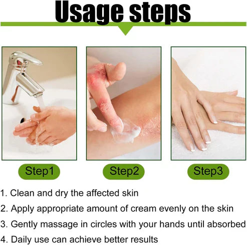 Todahof Biegenfift Psoriasis Treatment Crem, Todahof Biegenfift Psoriasis Treat Cream, Todahof Bienengift Cream, Psoriasis Cream, Beeergift Psoriasis Treatment Cream (3 pièces)