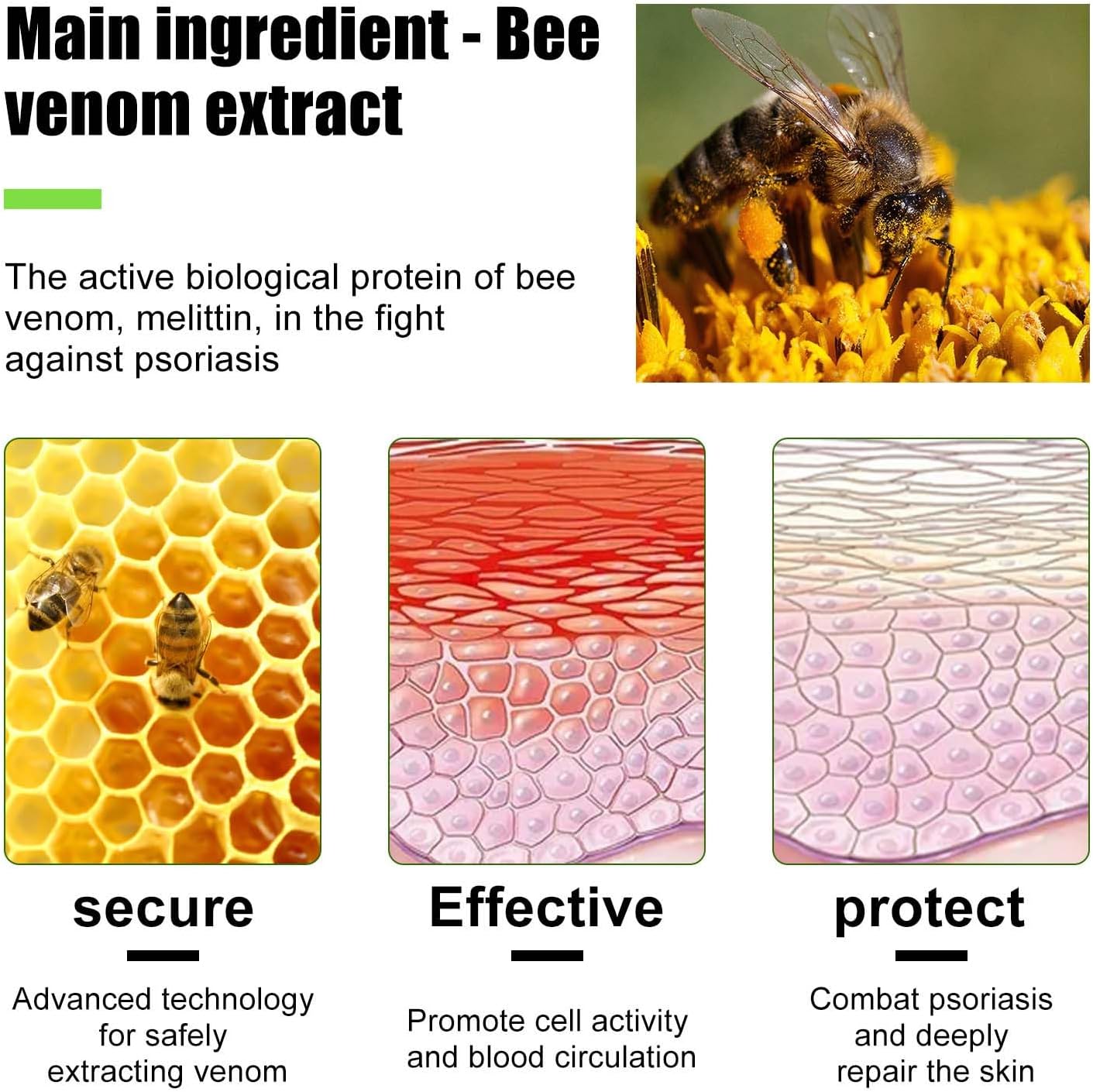 Todahof bienengift-psoriasis behandelingscrème, todahof bienengift-psoriasis behandeling crème, todahof bienengift-cream, psoriasis crème, beeergift psoriasis behandeling crème (3 stuks)