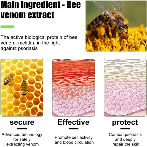 Todahof Biegenfift Psoriasis Treatment Crem, Todahof Biegenfift Psoriasis Treat Cream, Todahof Bienengift Cream, Psoriasis Cream, Beeergift Psoriasis Treatment Cream (3 pièces)