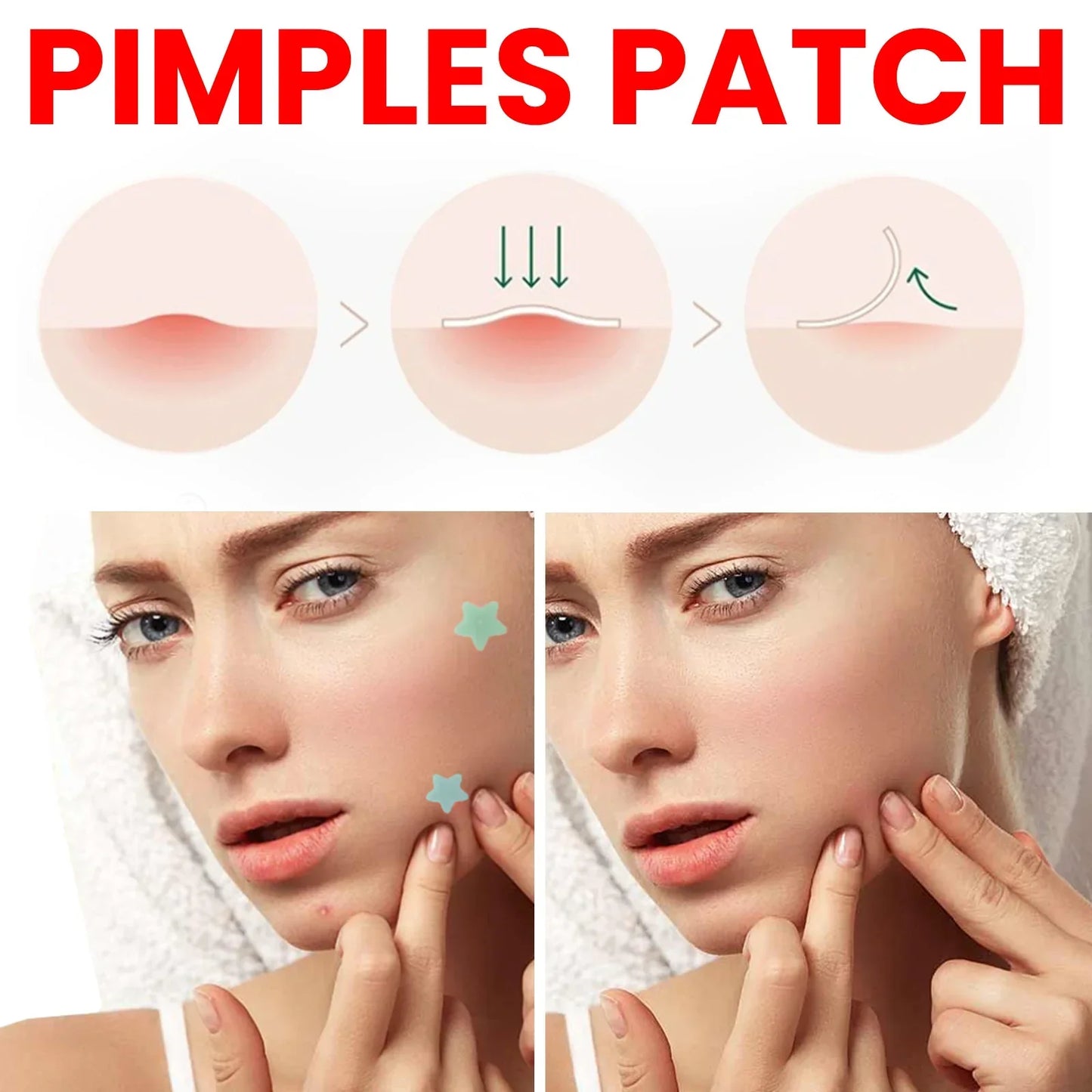 Pimpes d'huîtres pour le visage, pavée d'acné hydrocolloïde