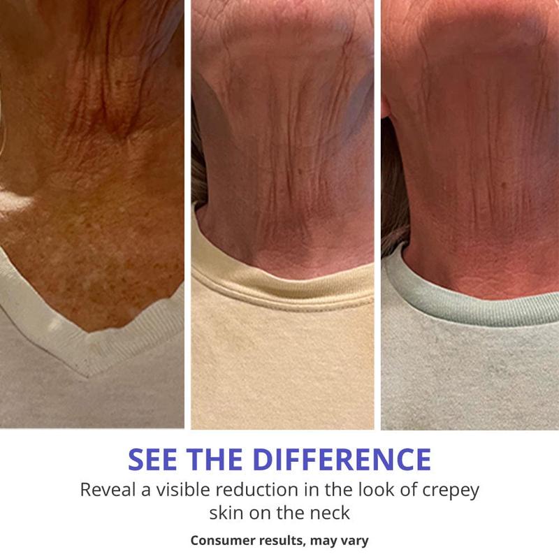 Gopure Cream Cream - Crème de cou taquin et taquinerie pour s'arrêter la peau