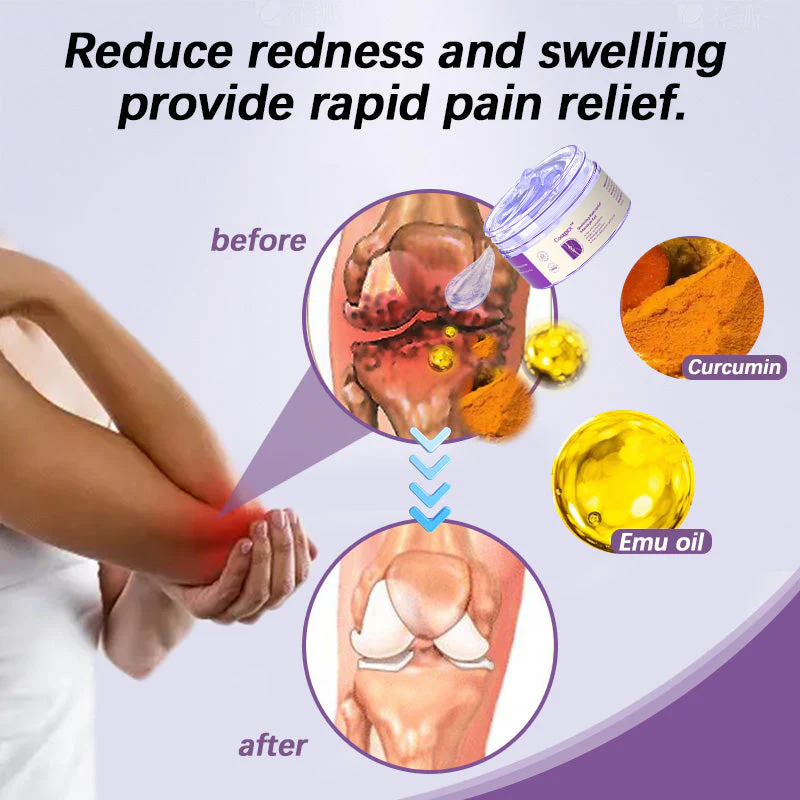 👩⚕️Gel de massage apaisant pour l'arthrite au curcuma et à l'huile d'émeu Cougex™ 👨⚕️Approuvé par l'Association australienne d'ostéopathie (AOA)
