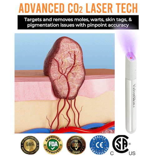 🇨🇦Stylo effaceur laser tout-en-un Bikenda® VelvetSkin+ (alimenté par la technologie laser CO₂ – élimine efficacement les grains de beauté, les verrues, les acrochordons, les taches pigmentaires et autres imperfections cutanées)