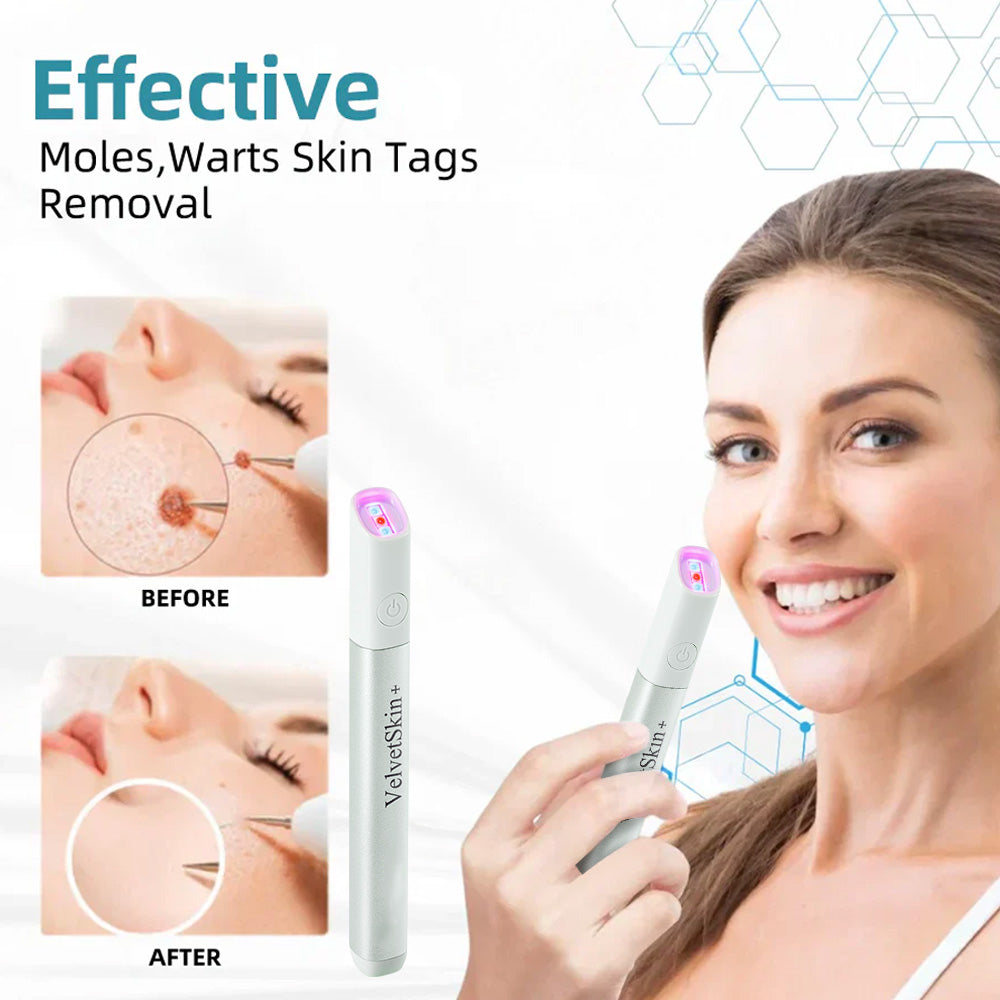 🇨🇦Stylo effaceur laser tout-en-un Bikenda® VelvetSkin+ (alimenté par la technologie laser CO₂ – élimine efficacement les grains de beauté, les verrues, les acrochordons, les taches pigmentaires et autres imperfections cutanées)