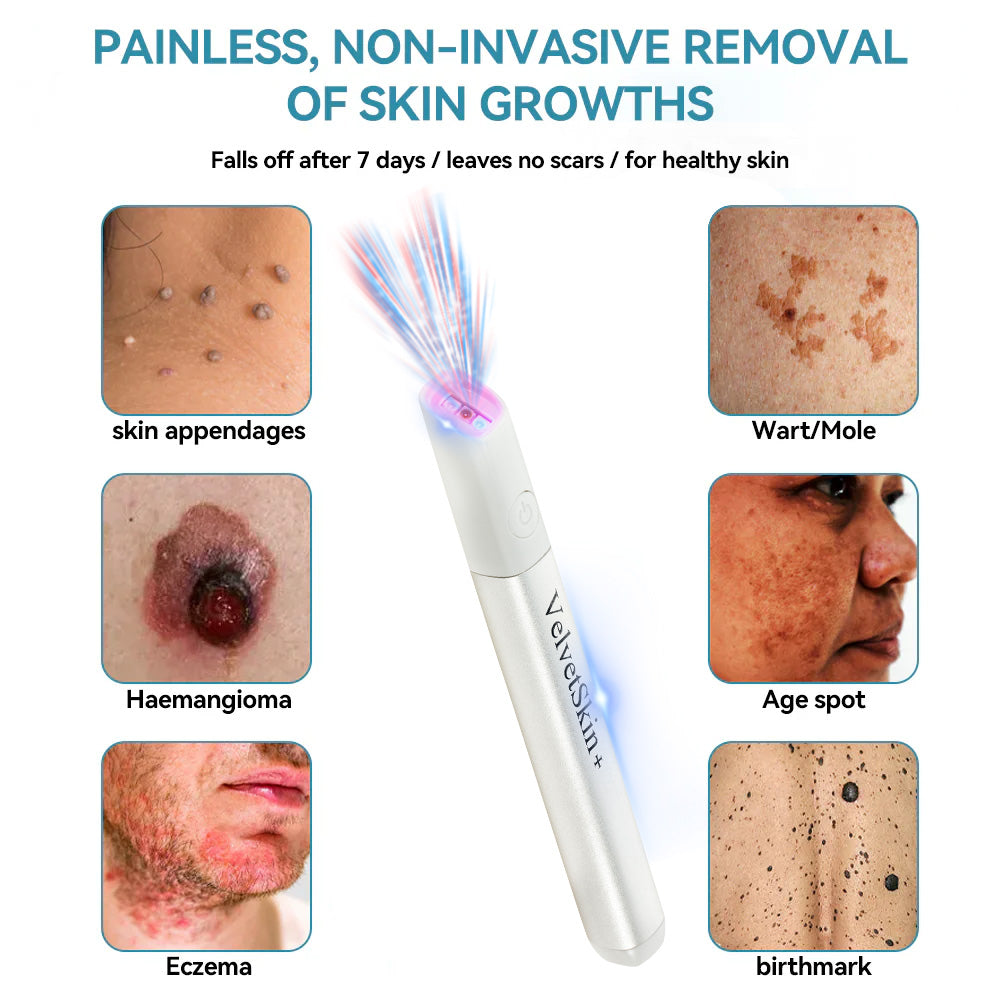 🇨🇦Stylo effaceur laser tout-en-un Bikenda® VelvetSkin+ (alimenté par la technologie laser CO₂ – élimine efficacement les grains de beauté, les verrues, les acrochordons, les taches pigmentaires et autres imperfections cutanées)