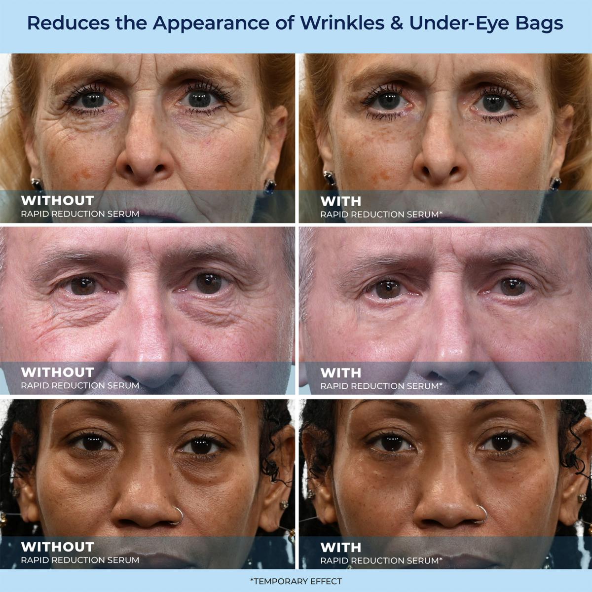 🔥Dernier jour de vente : 49 % de réduction sur le sérum anti-âge 60 secondes LBMLBM-HOYGI™ pour les rides, les poches sous les yeux et les cernes