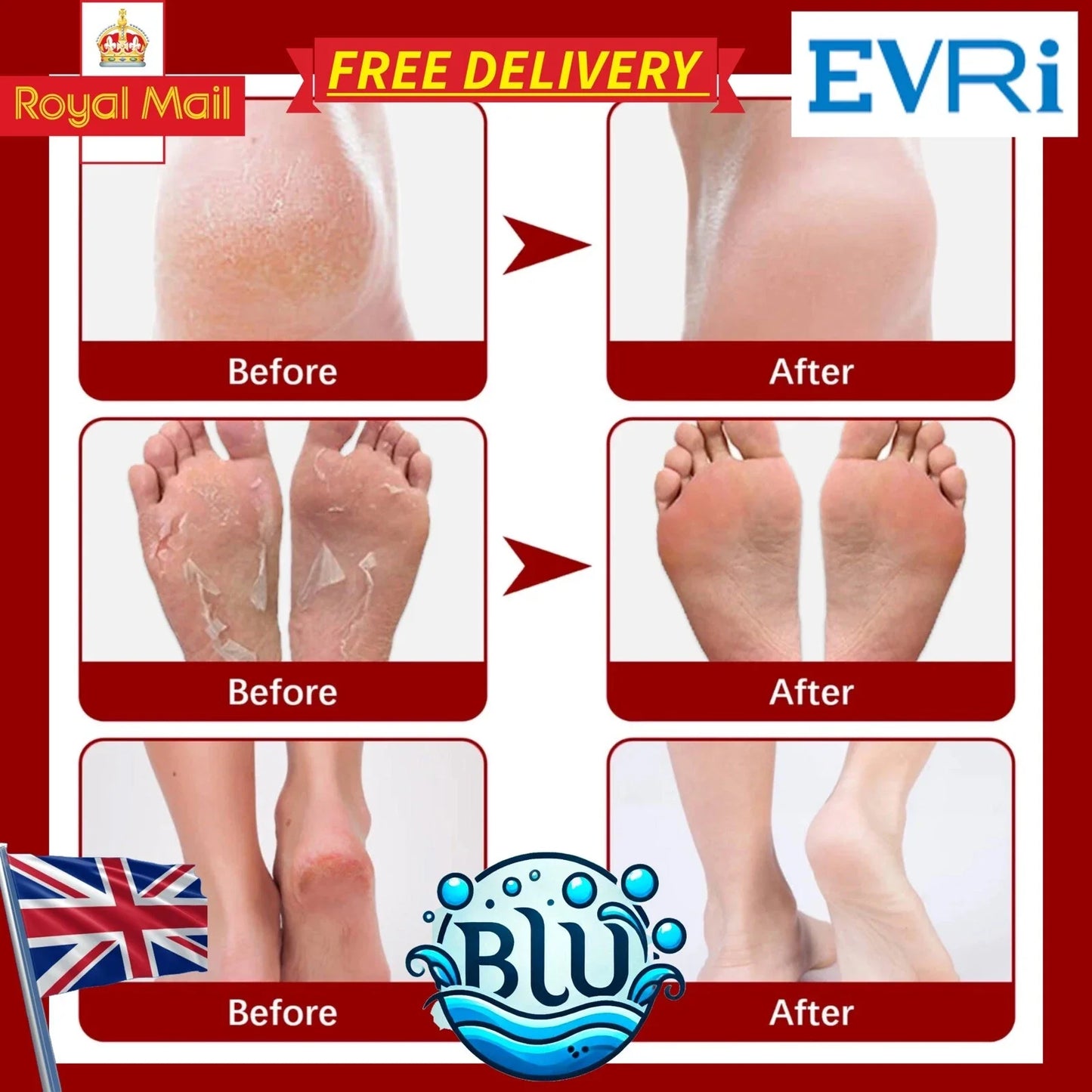 Miel naturel + soins aux pieds VITE, tue les champignons à pied, élimine les cellules mortes de la peau et rend les pieds aussi doux que les pieds de bébé