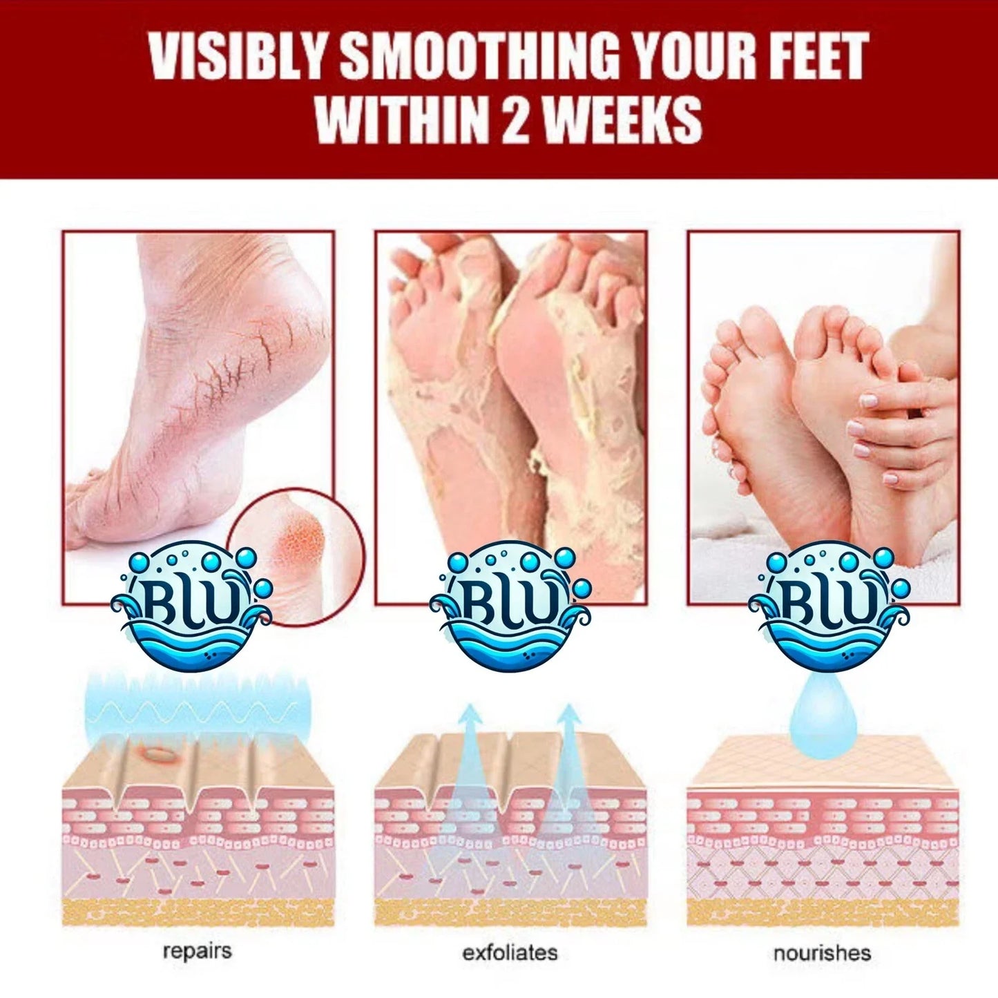 Miel naturel + soins aux pieds VITE, tue les champignons à pied, élimine les cellules mortes de la peau et rend les pieds aussi doux que les pieds de bébé