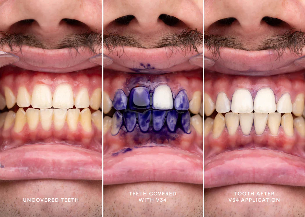 🔥Maintenant 40% de réduction🎁Sérum correcteur de couleur HismileV34 - Recherchez un dentifrice mousse violet pour des dents d'un blanc éclatant