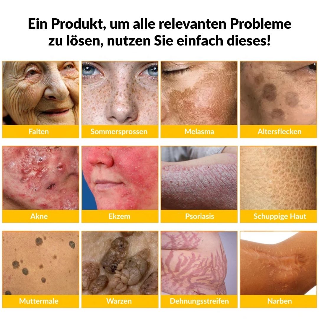 ✨✨Krém na obnovu pokožky s včelím jedem Ourlyard® - 🔥Časově omezená sleva 80 %🔥