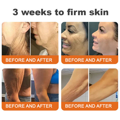 🐝💖Sérum raffermissant Flysmus™ Botox au venin d'abeille (fabriqué et expédié en Allemagne) – DERNIER JOUR -70 %
