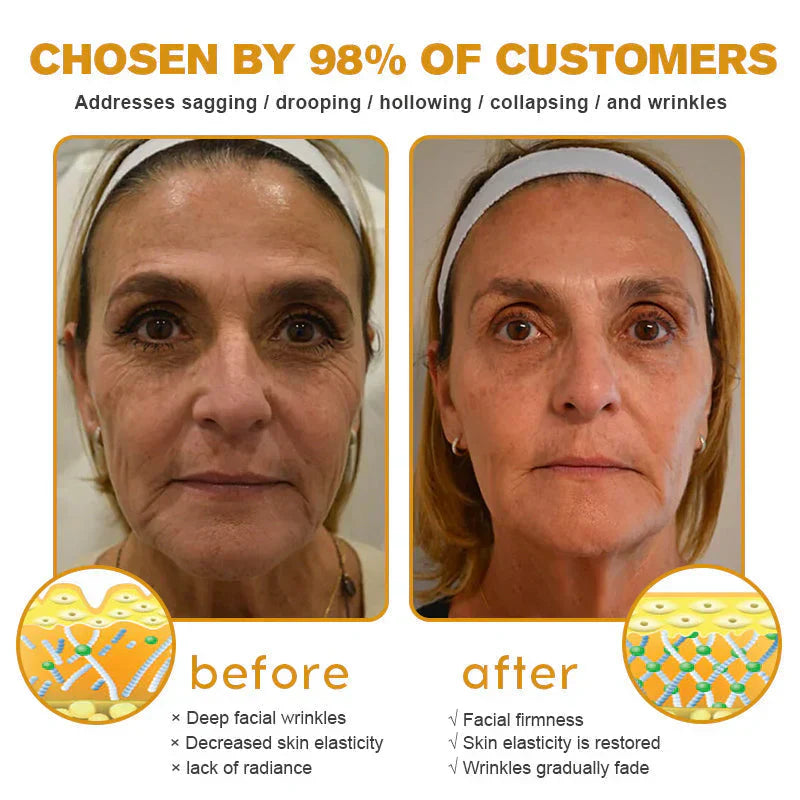 👨‍⚕️ Fabriqué et expédié en Allemagne ✅ Crème antirides au venin d'abeille et au Botox – DERNIER JOUR -80 %