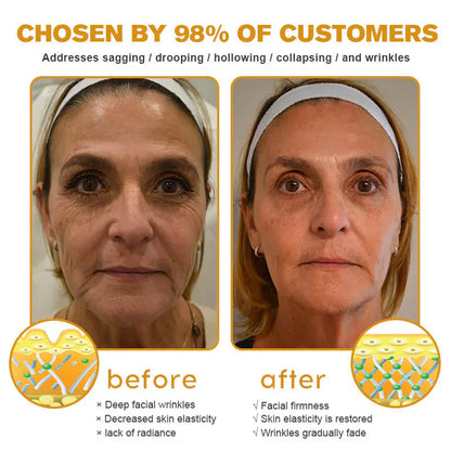 👨‍⚕️ Fabriqué et expédié en Allemagne ✅ Crème antirides au venin d'abeille et au Botox – DERNIER JOUR -80 %