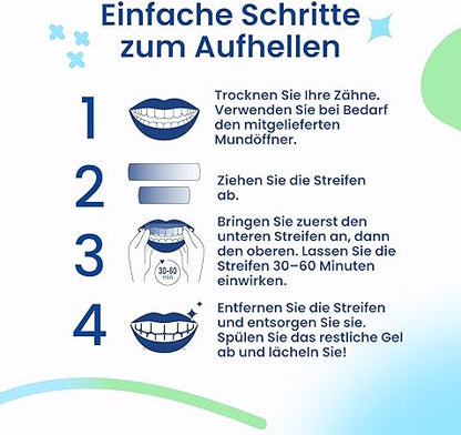 👨‍⚕️Recommandé par le CED✅Bandes de blanchiment dentaire professionnelles 21 applications - Sans danger pour l'émail - Sans sensibilité - Bandes de blanchiment dentaire professionnelles - 42 bandes + ouvre-bouche inclus