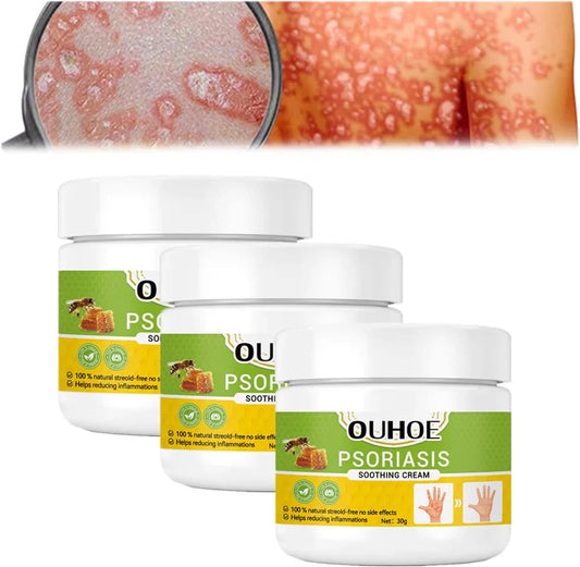 Todahof Biegenfift Psoriasis Treatment Crem, Todahof Biegenfift Psoriasis Treat Cream, Todahof Bienengift Cream, Psoriasis Cream, Beeergift Psoriasis Treatment Cream (3 pièces)