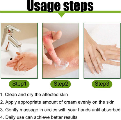 Todahof bienengift-psoriasis behandelingscrème, todahof bienengift-psoriasis behandeling crème, todahof bienengift-cream, psoriasis crème, beeergift psoriasis behandeling crème (3 stuks)