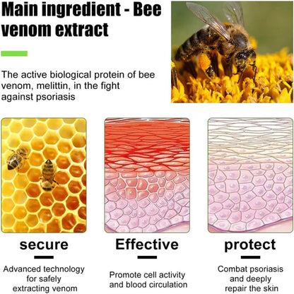 Todahof Biegenfift Psoriasis Treatment Crem, Todahof Biegenfift Psoriasis Treat Cream, Todahof Bienengift Cream, Psoriasis Cream, Beeergift Psoriasis Treatment Cream (3 pièces)