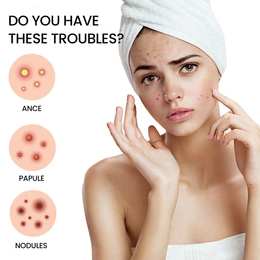 Pimpes d'huîtres pour le visage, pavée d'acné hydrocolloïde