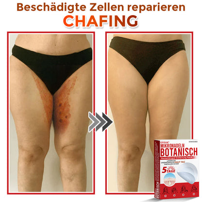 Patch botanique de micro-aiguilletage GFOUK® pour l'élimination des acrochordons 🇩🇪 Fabriqué en Allemagne