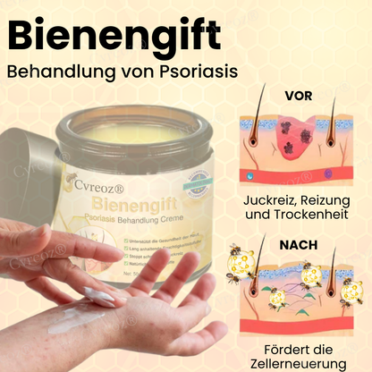 CVREOZ® BEENENGIFT PSORIASIS TRAITEM