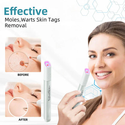 🇨🇦Bikenda® VelvetSkin+ All-in-One Laser Eraser Pen (aangedreven door CO₂-lasertechnologie – verwijdert effectief moedervlekken, wratten, huidflapjes, pigmentvlekken en andere huidimperfecties)